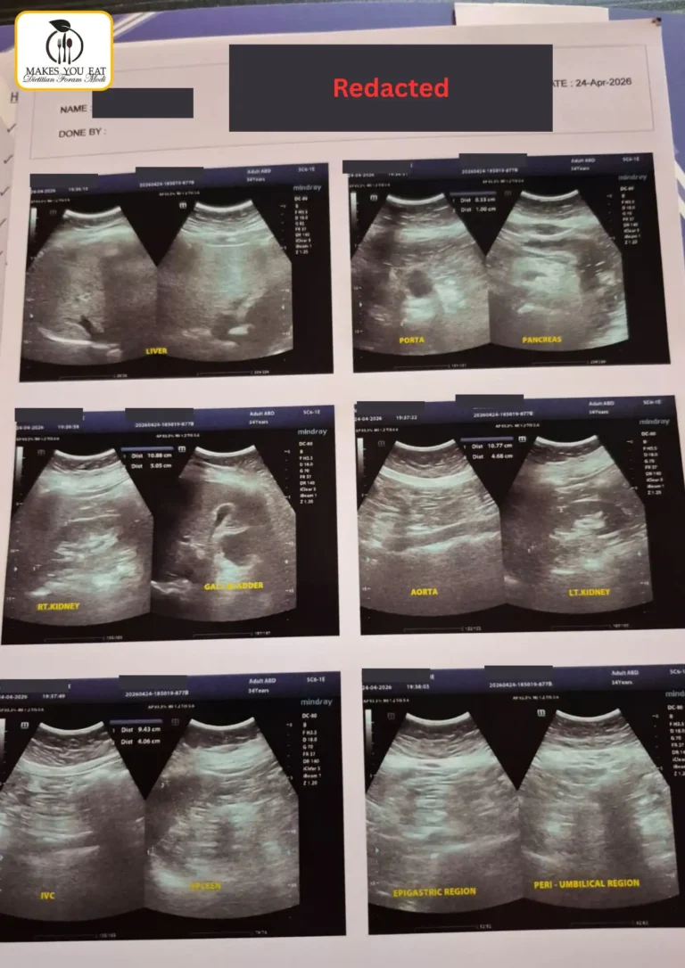 Sonography report film - PCOS lab test report 1