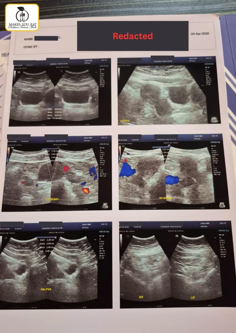 Sonography report film - PCOS lab test report 2