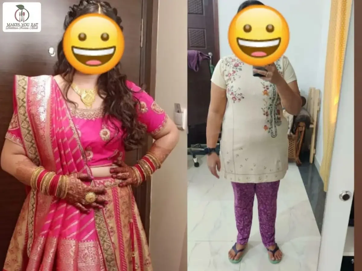 Anti Inflammatory Diet Before After Photo in Mumbai.