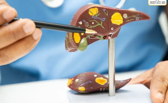 Indian Dietitian for Fatty Liver Diet in Qatar, UAE - Dt. Foram Modi, Mumbai