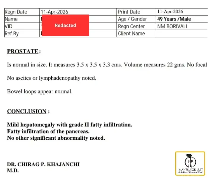 Liver and Prostate profile report of client