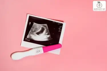 Preconception diet plan by Fertility Dietitian Dt. Foram Modi