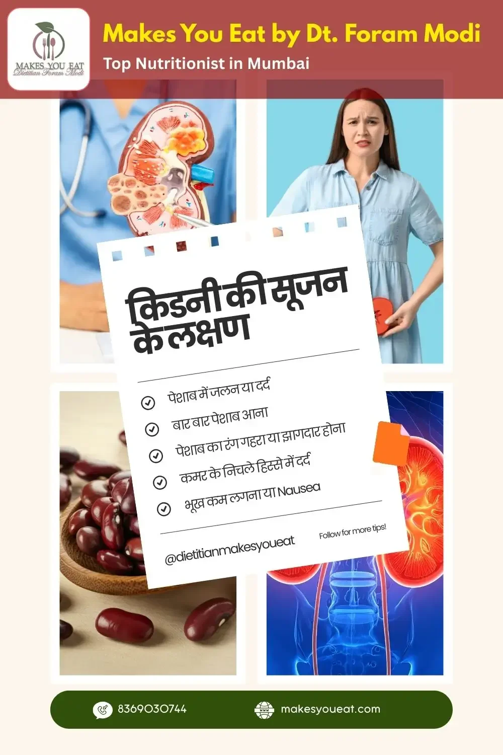 किडनी की सूजन के लक्षण